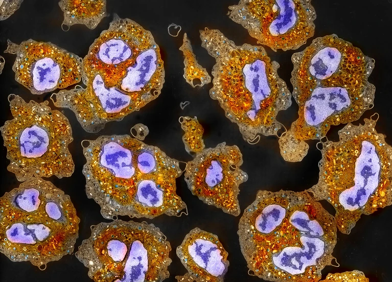 d44151-025-00074-6_50955992